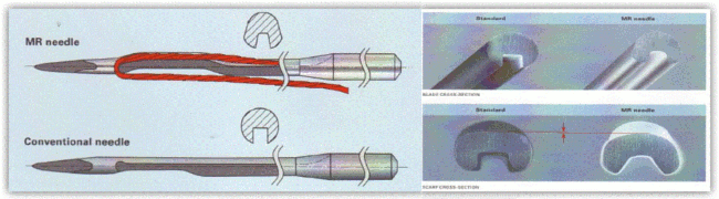 MR針-普通針　比較図